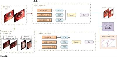 Comparisons of artificial intelligence algorithms in automatic segmentation for fungal keratitis diagnosis by anterior segment images